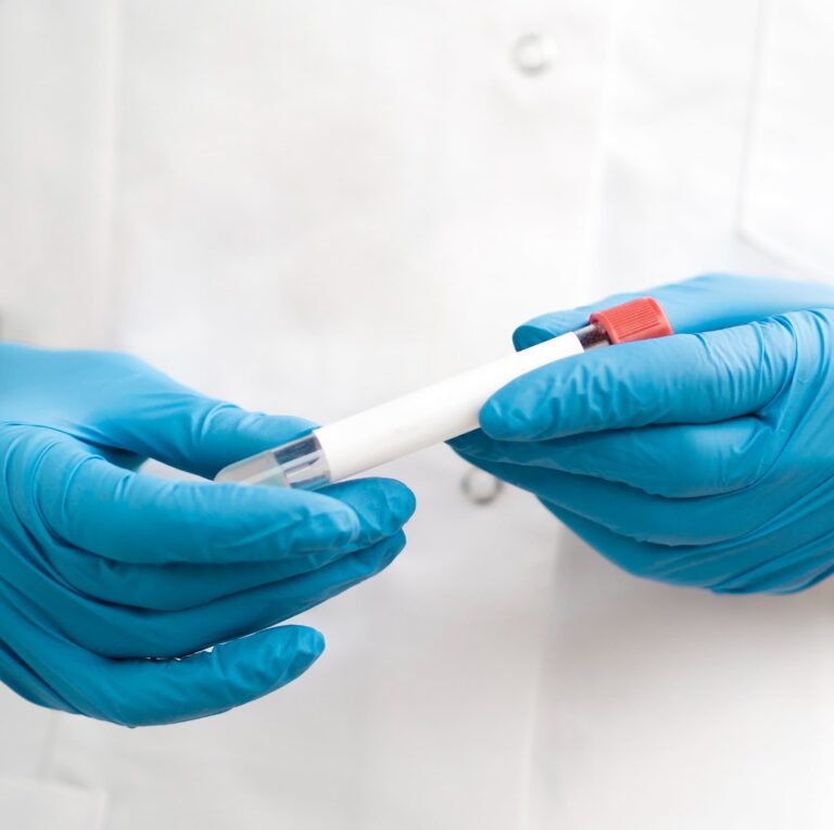 test epigenético salta